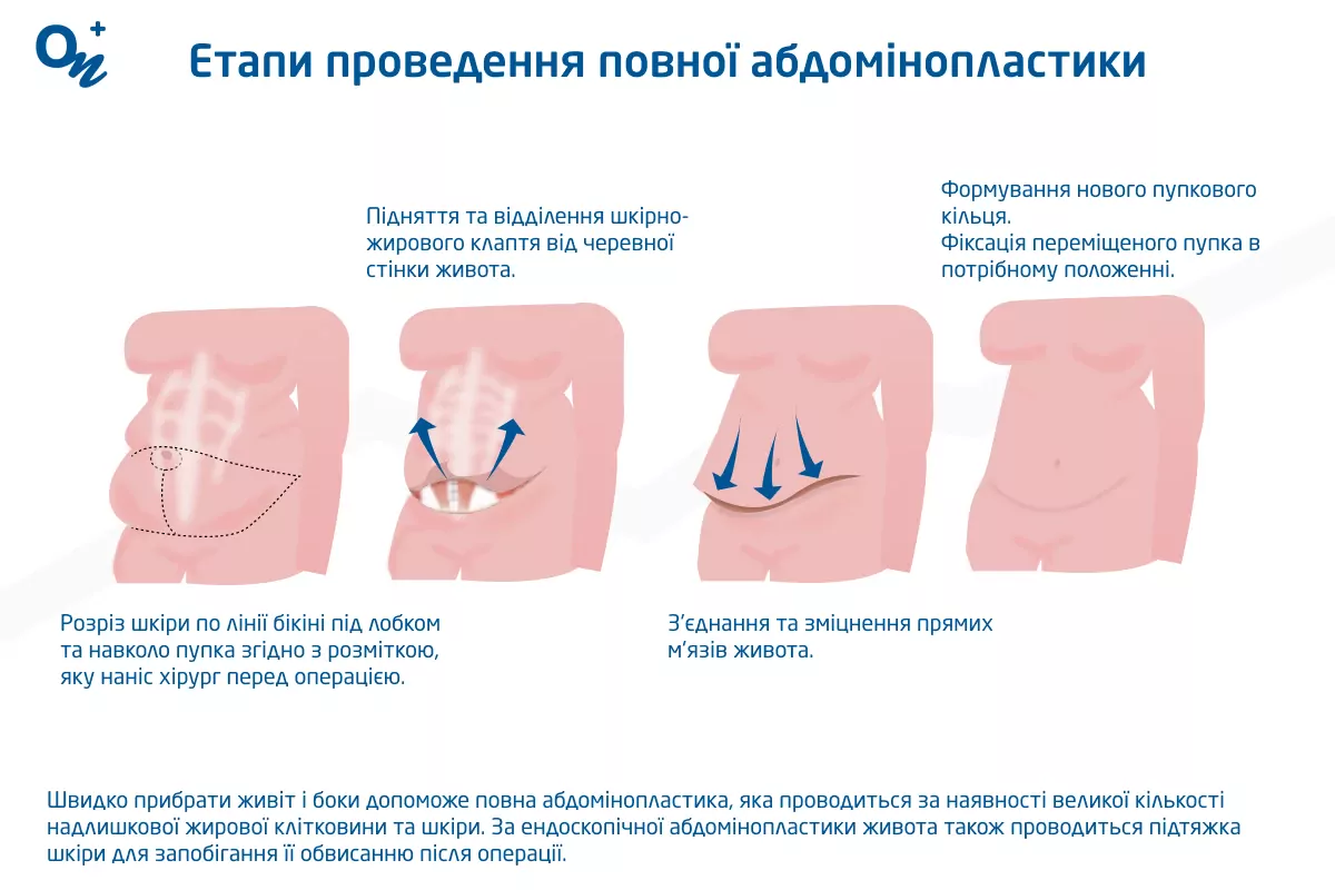 Поиск объявлений