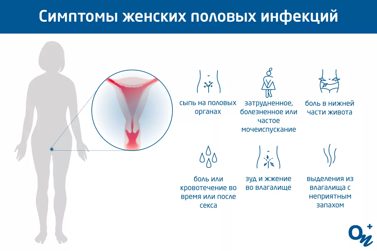 Проявления ЗППП в ротовой полости