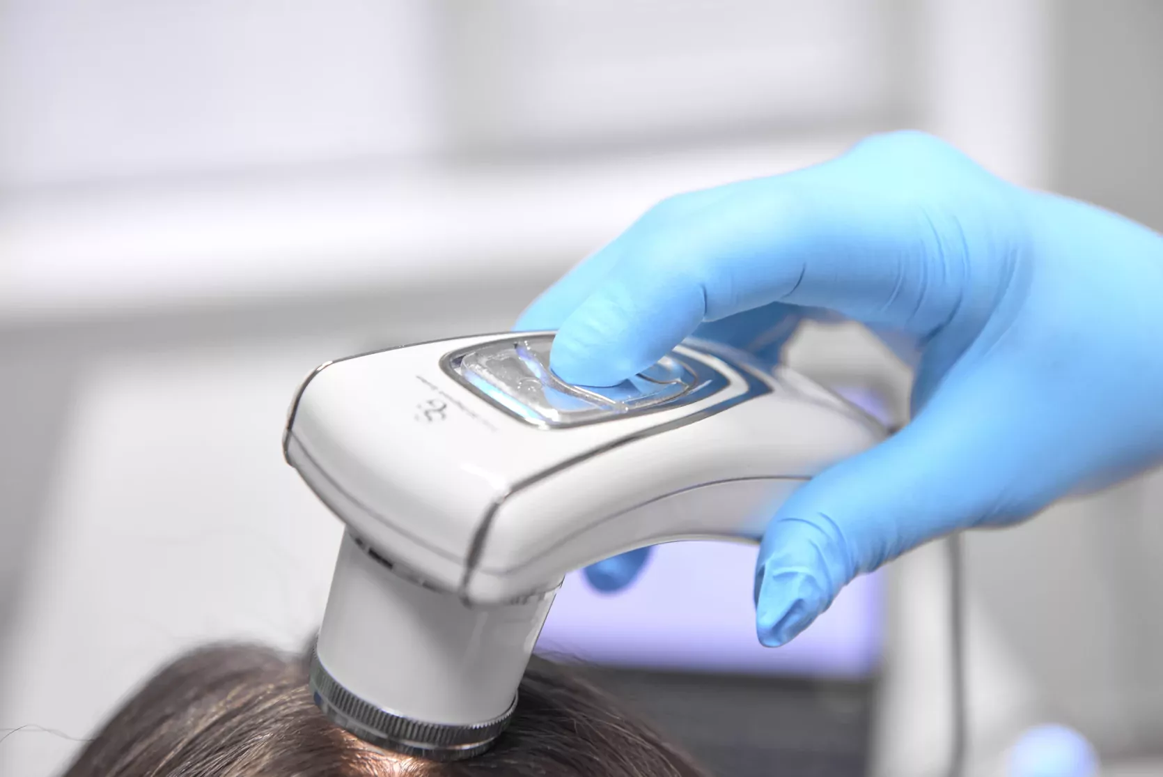 аппарат для диагностики волос и кожи головы в медицинском центре ОН Клиник Белая Церковь