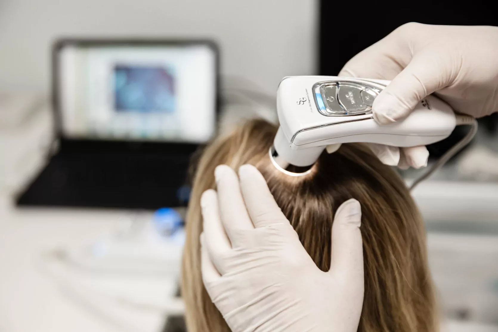 трихоскоп для діагностики пошкоджень волосся в медичному центрі ОН Клінік Чернігів