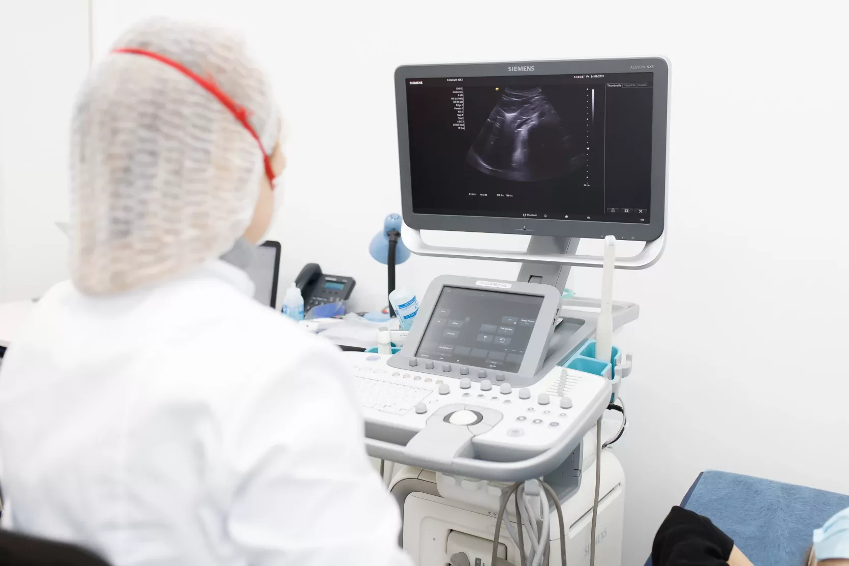 апарат для проведення УЗД органів черевної порожнини в медичному центрі ОН Клінік Дніпро