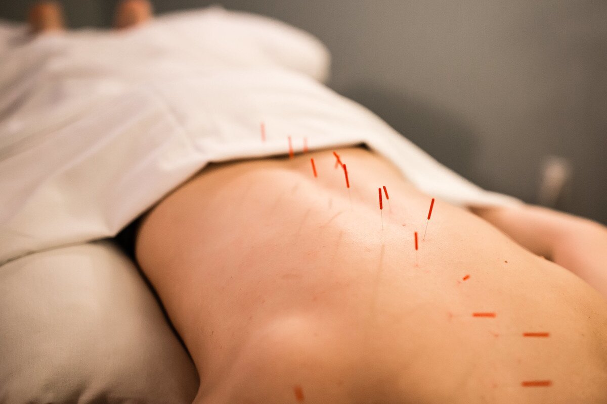 Акупунктурний (точковий) масаж спини