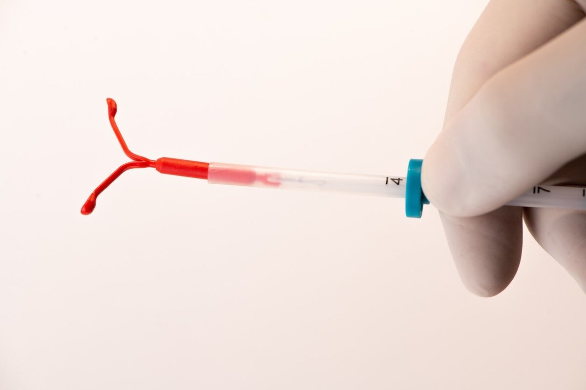 внутрішньоматкова спіраль