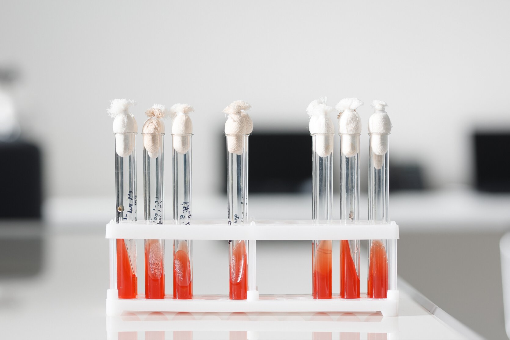 Бактериологические исследования в лаборатории «ОН Клиник»