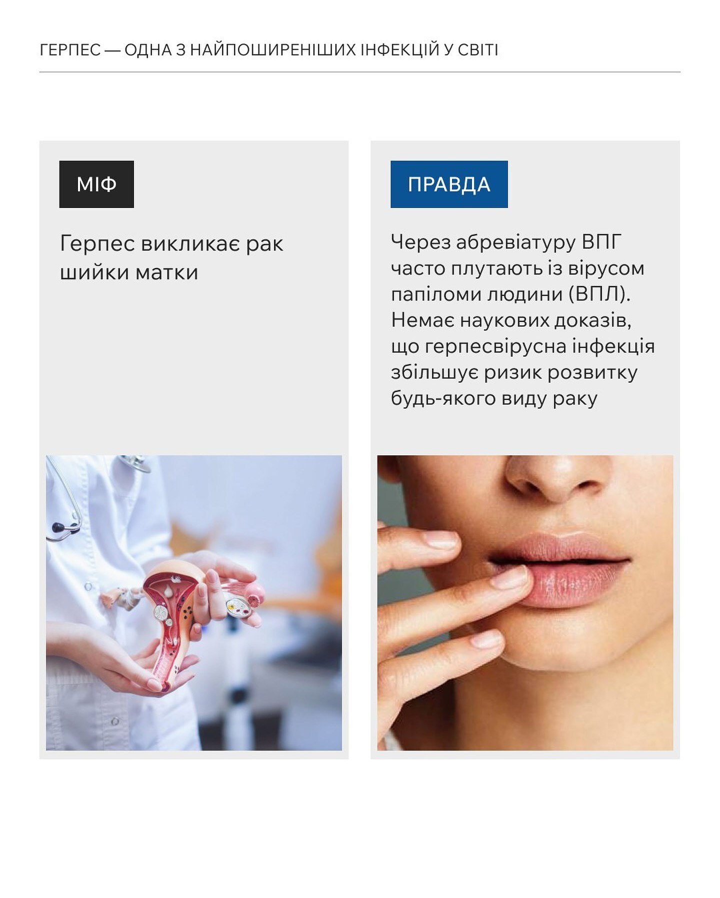 Чи викликає герпес рак шийки матки?