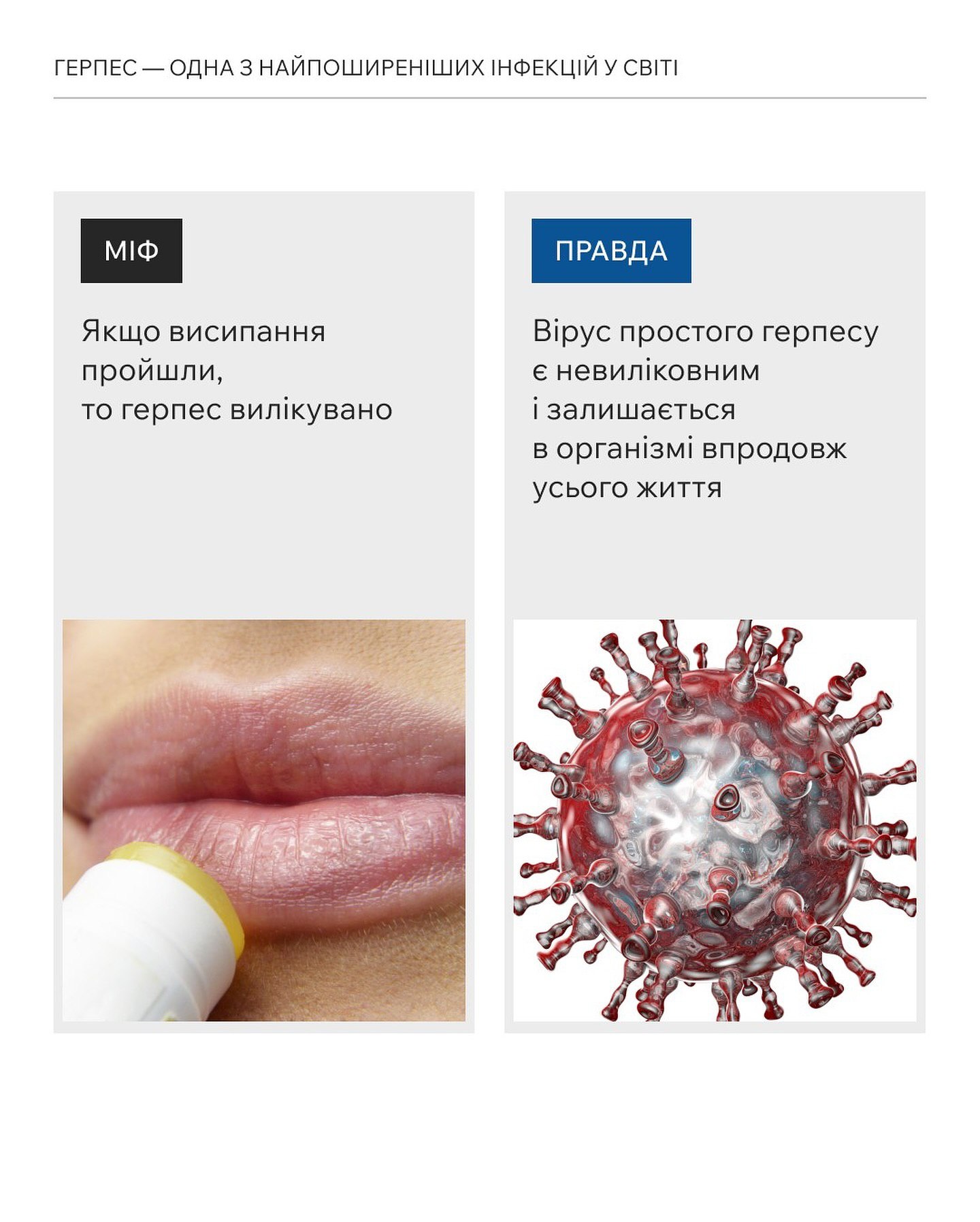 Чи можна назавжди вилікувати простий герпес?