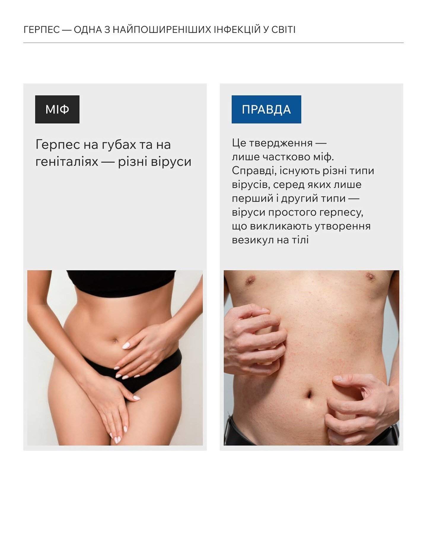 Герпес на губах та статевих органах викликає різний вірус?