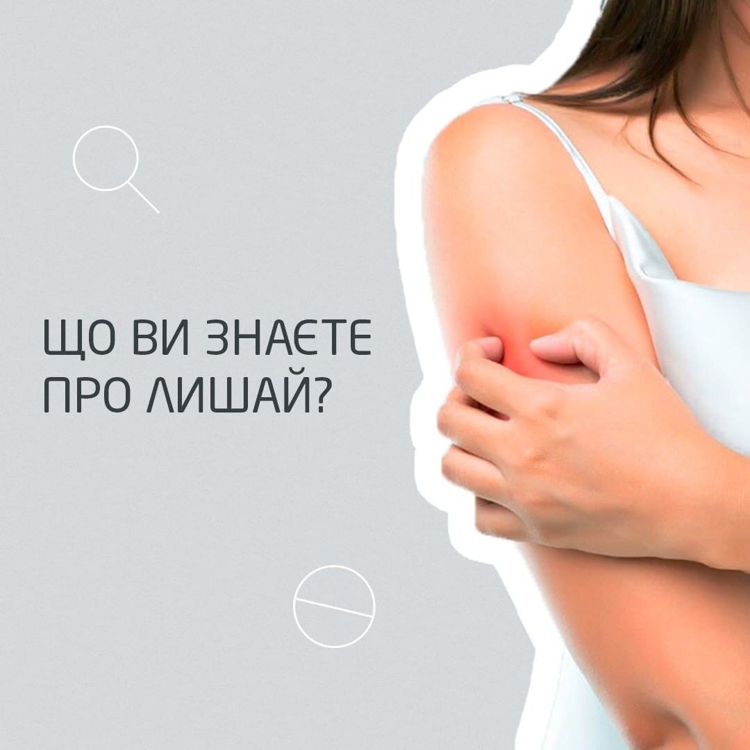Що ви знаєте про лишай?