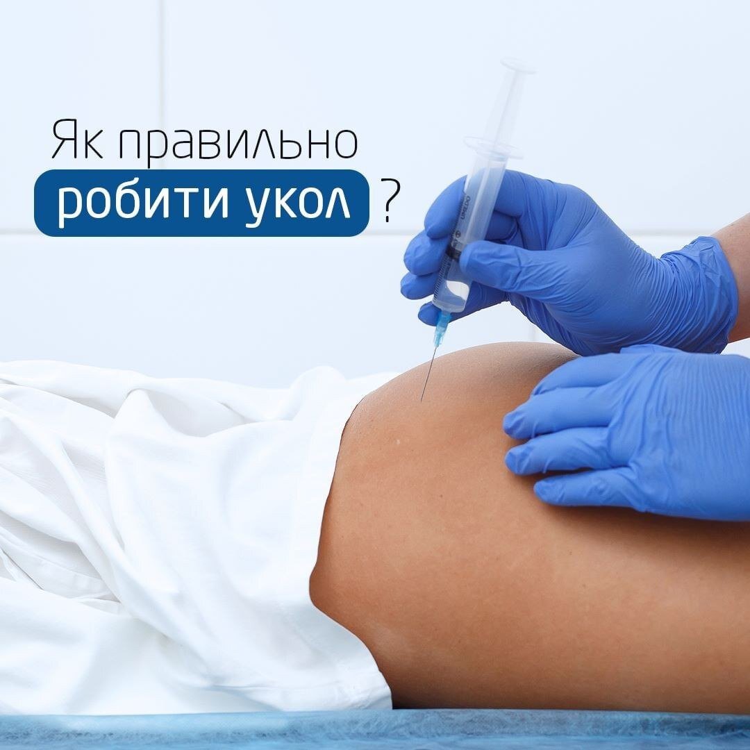 Як правильно робити внутрішньо-м’язову ін’єкцію (укол)?