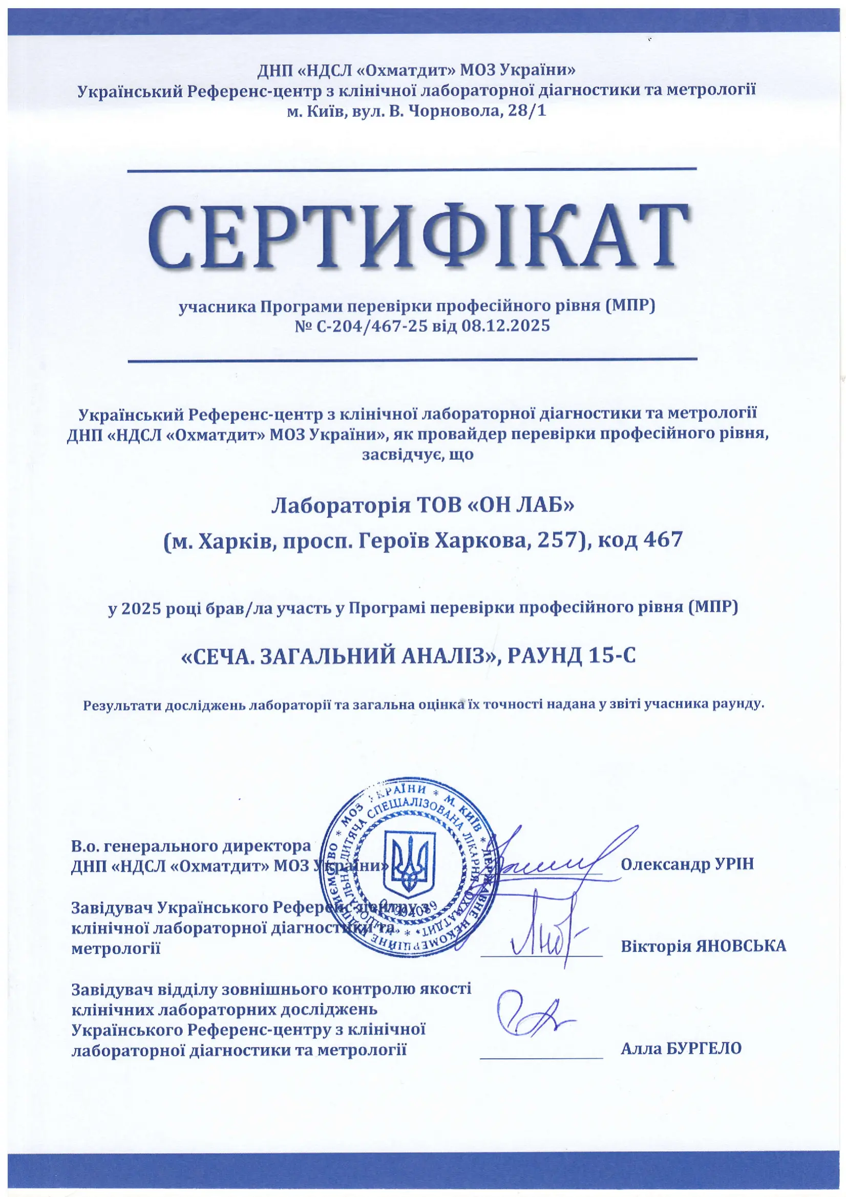 Моча - общий анализ