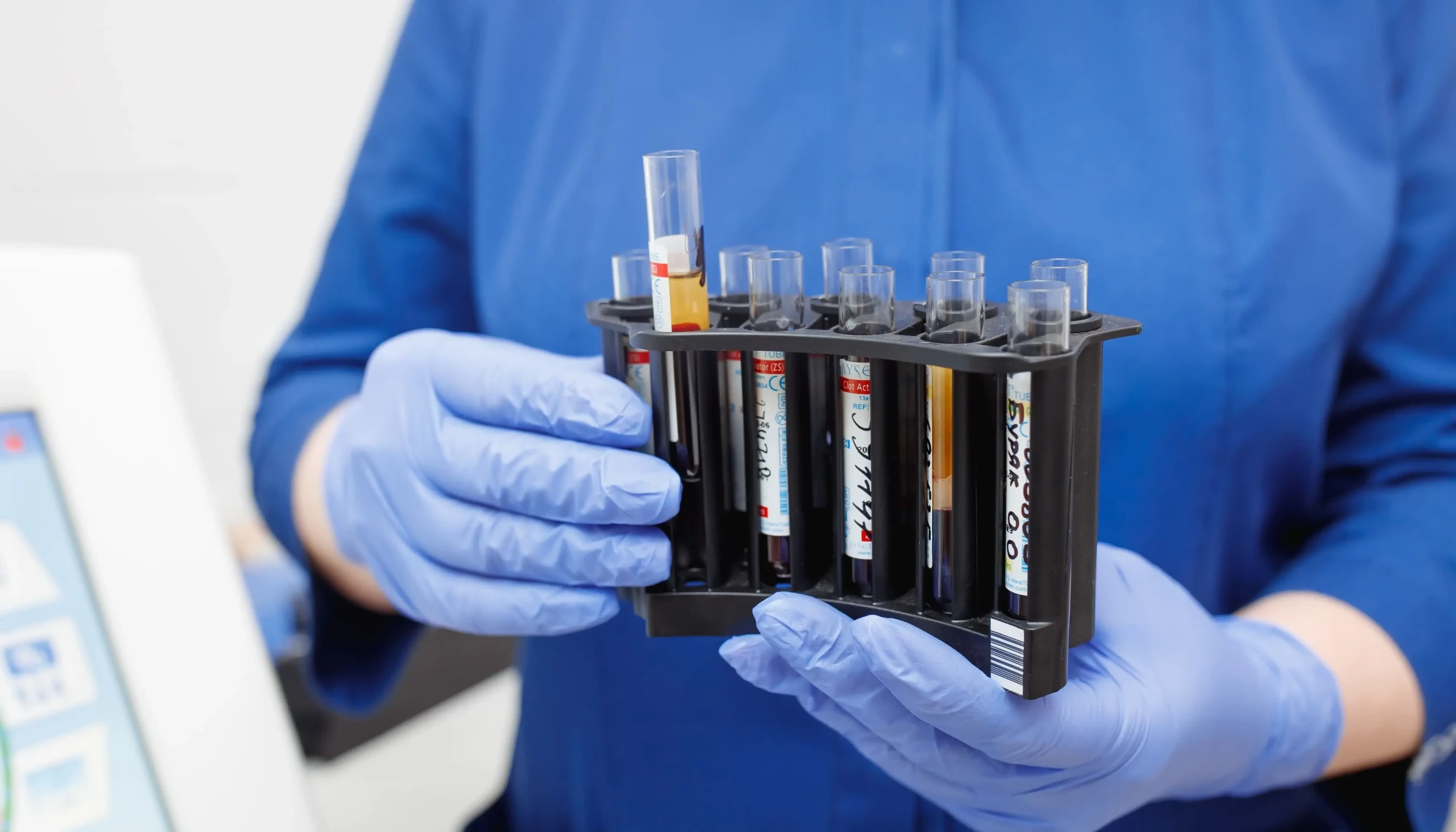 Скидка 30% на пакет анализов «Сердечно-сосудистое здоровье» в «ОН Клиник Белая Церковь»