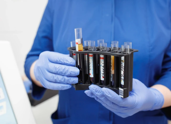 Знижка 30% на пакет аналізів «Серцево-судинне здоров'я» в «ОН Клінік Біла Церква»