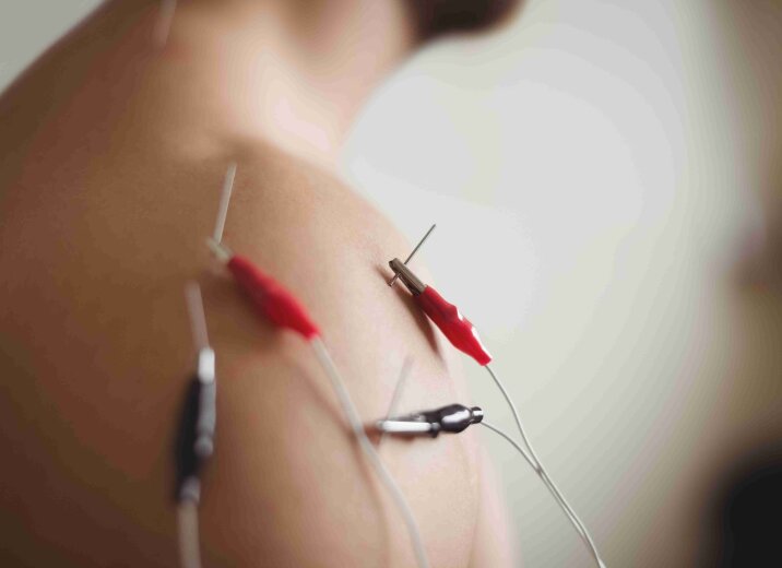 Новая услуга — игольчатая электронейромиография в «ОН Клиник Харьков» (м. Ярослава Мудрого)