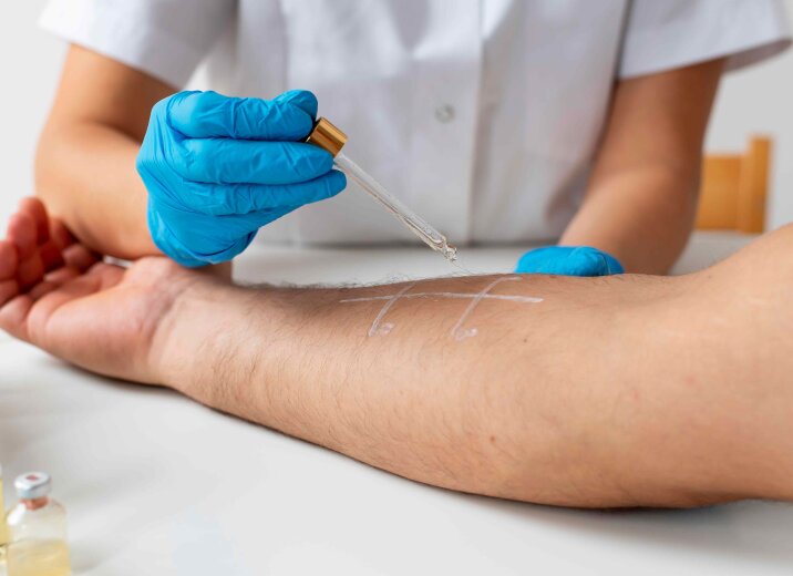 В «ОН Клиник Белая Церковь» открылось отделение аллергологии