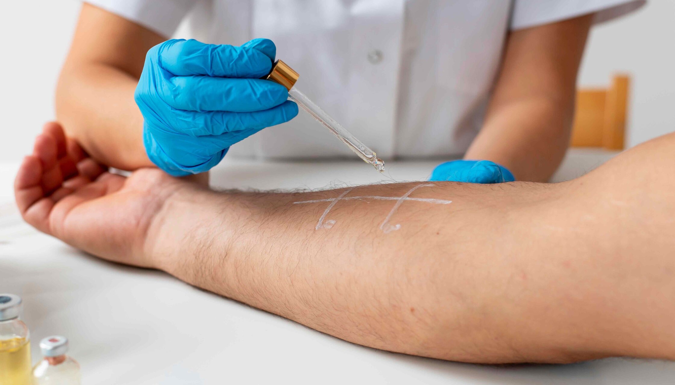 В «ОН Клиник Белая Церковь» открылось отделение аллергологии