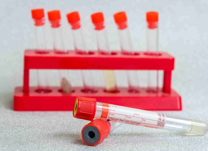 Знижка 30% на пакет аналізів «Мінеральний обмін» в «ОН Клінік Біла Церква»