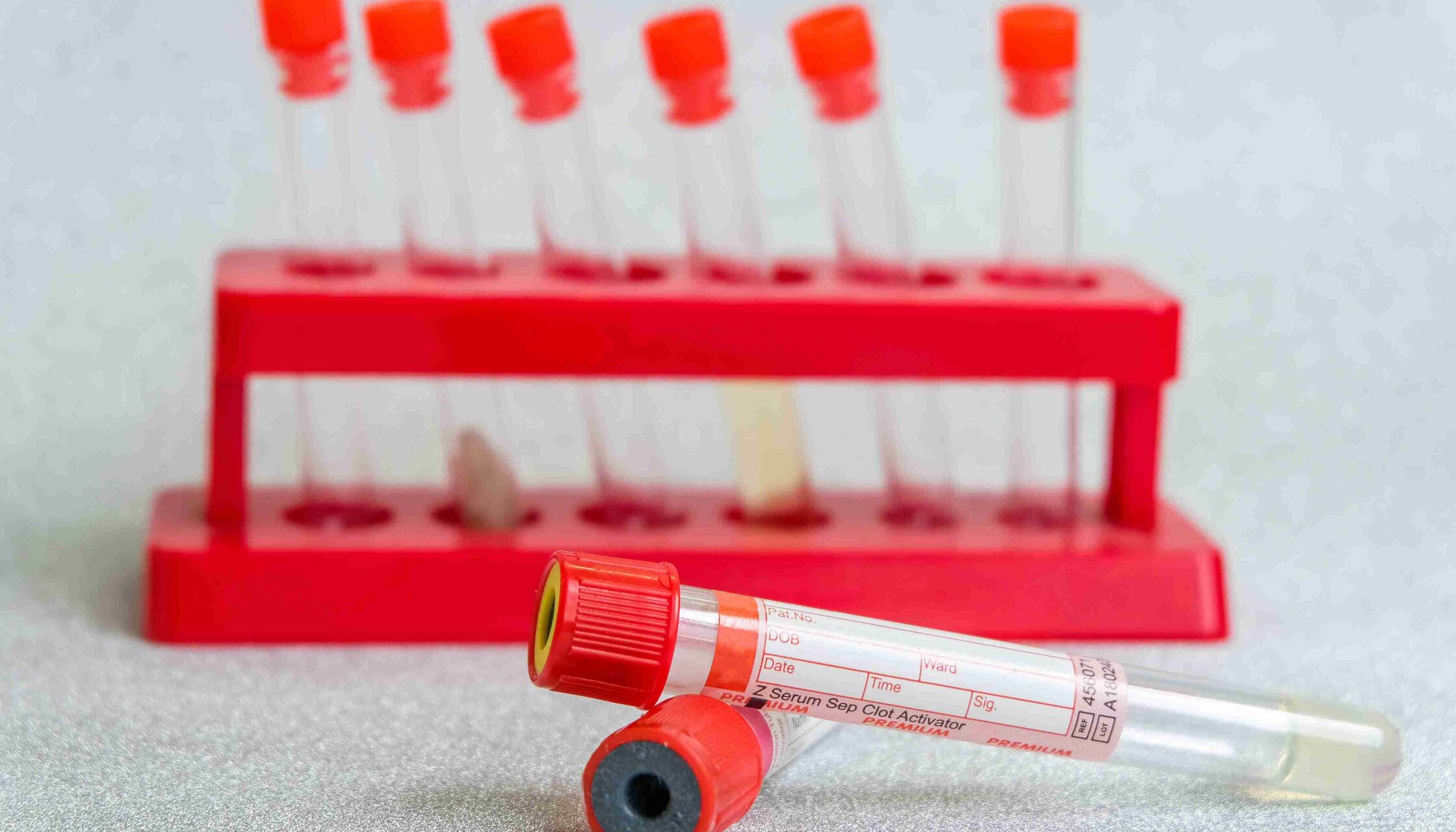 Знижка 30% на пакет аналізів «Мінеральний обмін» в «ОН Клінік Біла Церква»