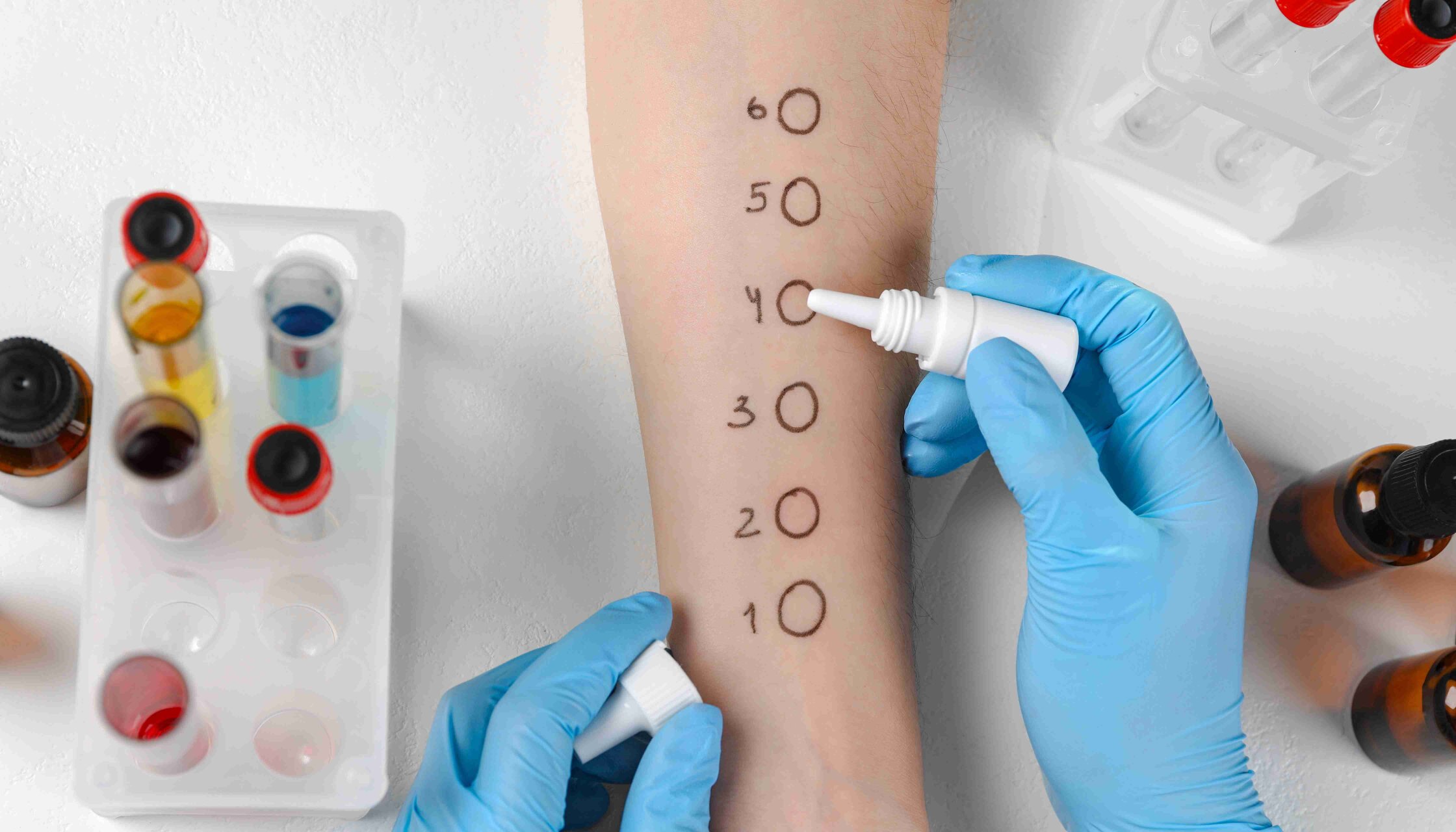 В «ОН Клиник Днепр» начало работу отделение аллергологии