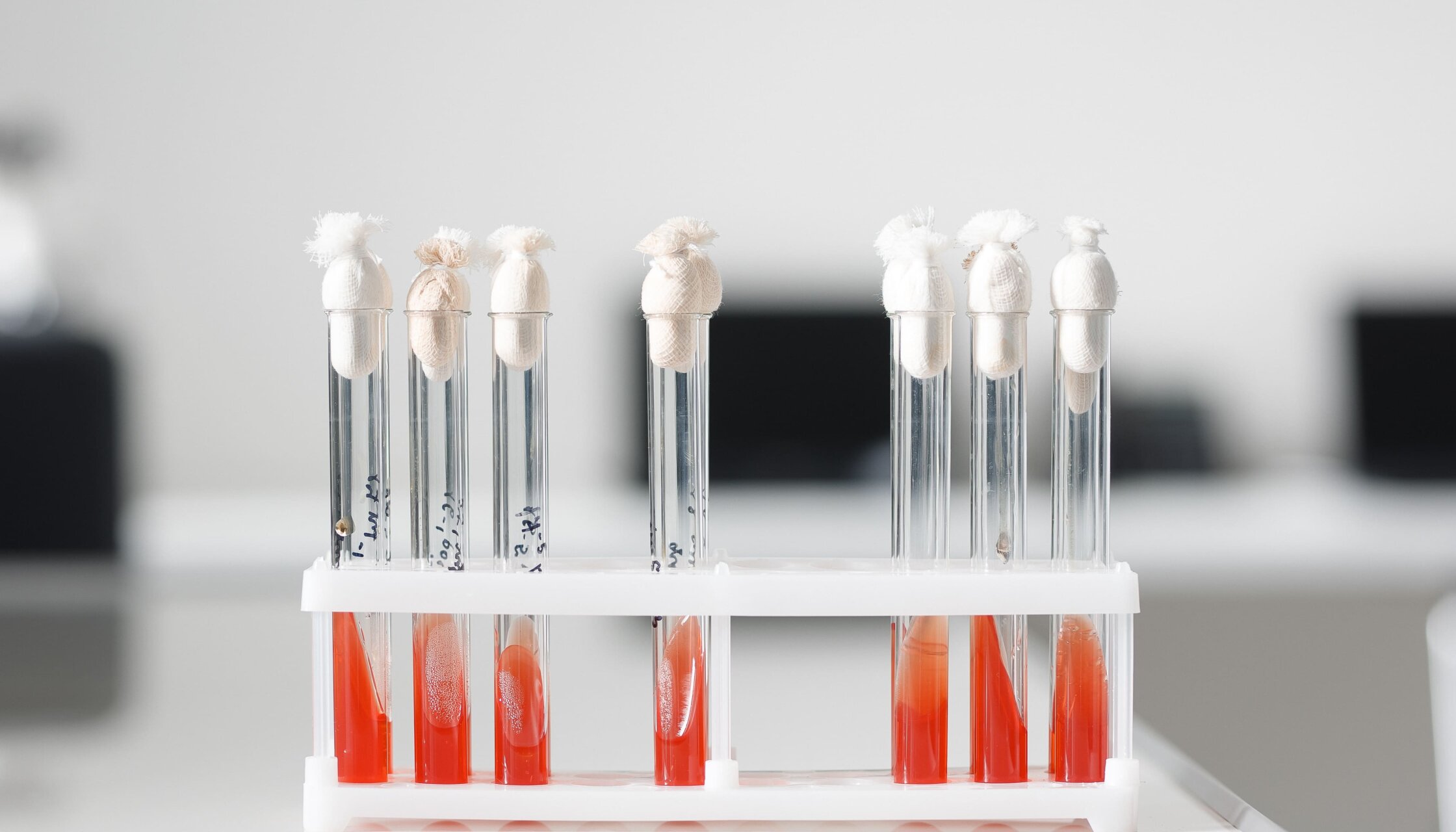 Знижка 30% на пакет аналізів «Паразитарний» в «ОН Клінік Біла Церква»