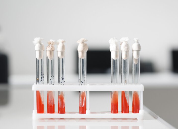 Скидка 30% на пакет анализов «Паразитарный» в «ОН Клиник Белая Церковь»