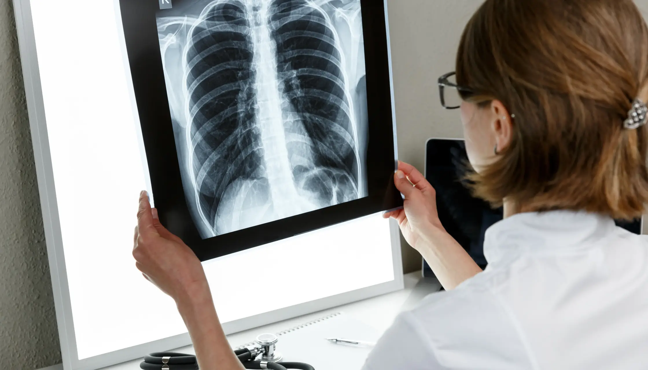 Скидка 15% на рентгенографию органов грудной клетки в «ОН Клиник Днепр»