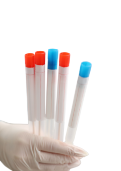 Акція! -30% на аналізи «Мінеральний обмін» в «ОН Клінік Біла Церква»